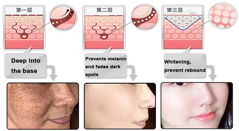 phenethyl resorcinol powder Whitening phenethyl resorcinol powder Whitening